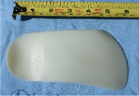 Backside of 3D Printed Orthotic